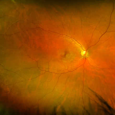 Close up of eye scan