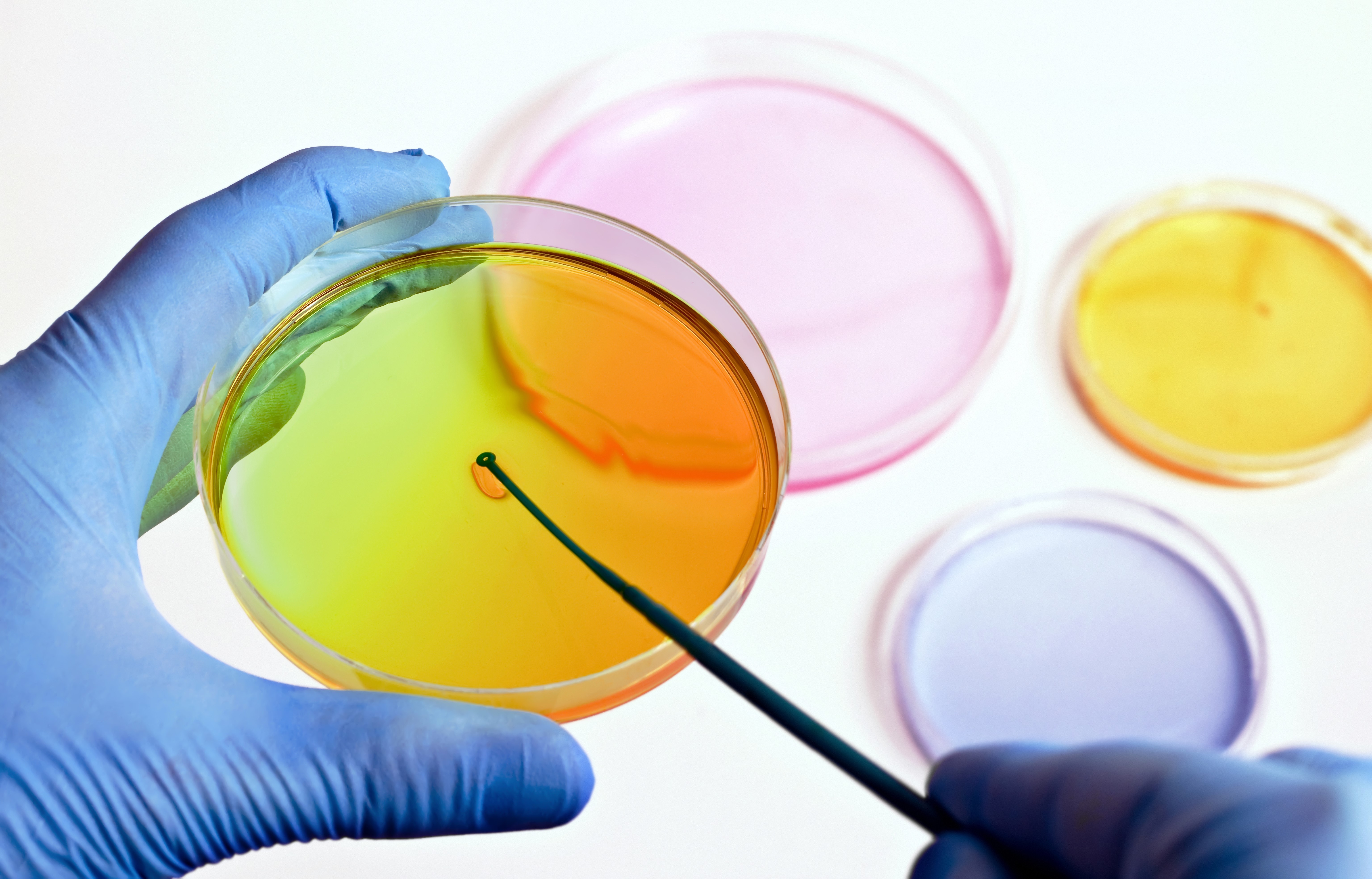Close up hands holding petri dishes